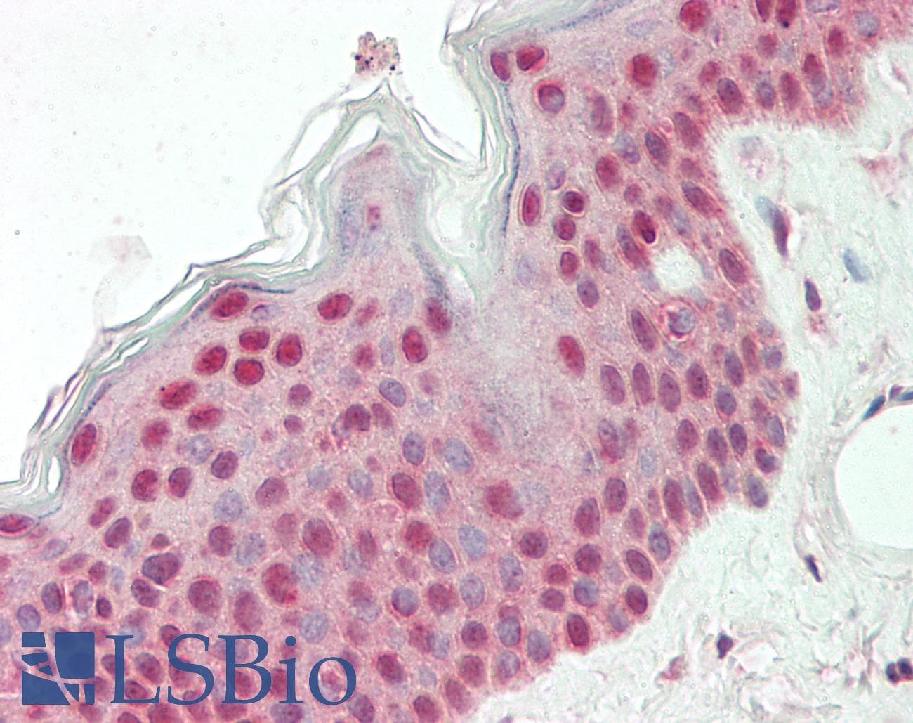 PPP1R13L / iASPP Antibody (aa501-550)