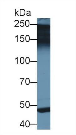 PAPPA2 / Pappalysin 2 Antibody (aa888-1093)