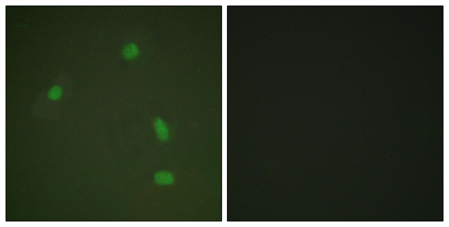 PR / Progesterone Receptor Antibody (phospho-Ser400)