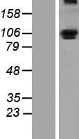 ALDH1L1 Protein (Over-Expression Lysate Myc-DDK (Flag))