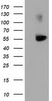 SQSTM1 Antibody (clone OTI5A2)