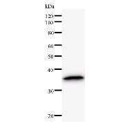 Monoclonal Mouse anti-Human CNOT2 Antibody (clone 2191C2a, WB)