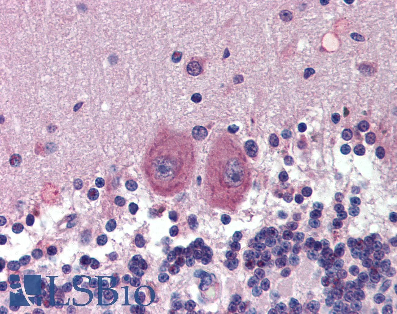 IHC-plus™ HDAC3 Antibody (clone 7G6C5)