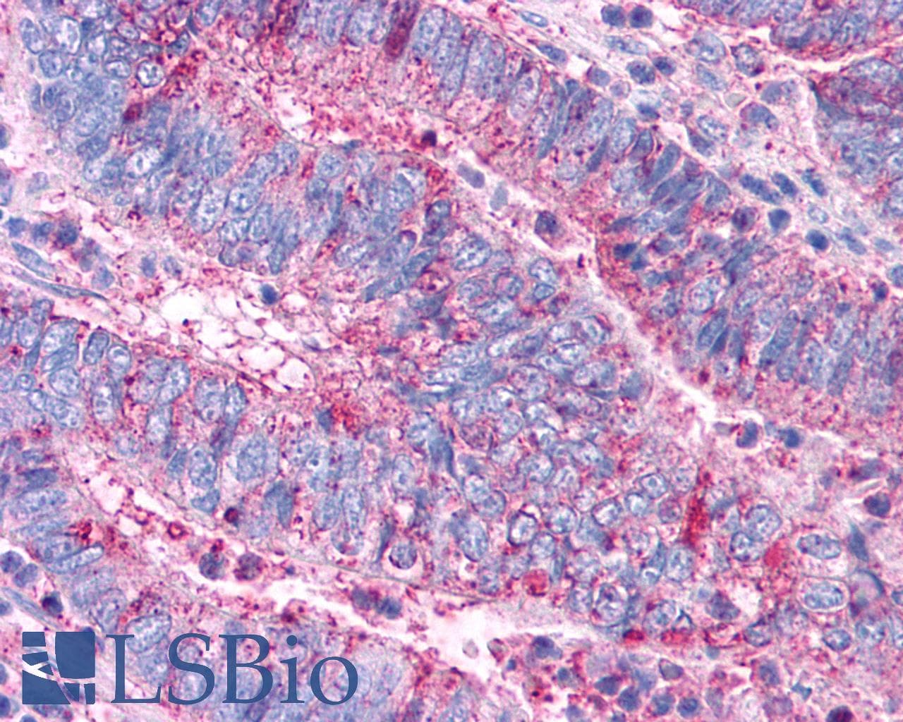 PathPlus™ Polyclonal Rabbit anti-Human VPAC2 / VIPR2 Antibody (C-Terminus, IHC)