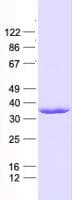 Human CENPQ Protein (Recombinant His, N-Terminal)