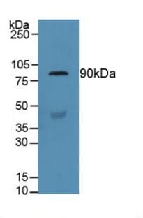 GSN / Gelsolin Antibody (aa432-625)