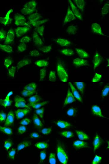 TRAF6 Antibody