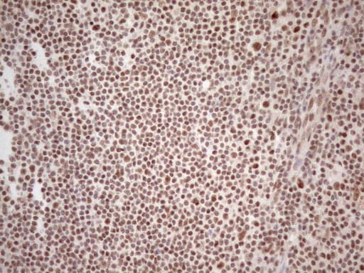 WTAP Antibody (aa2-106, clone OTI12G7, Carrier-free)