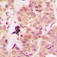 PTEN Antibody (C-Terminus)