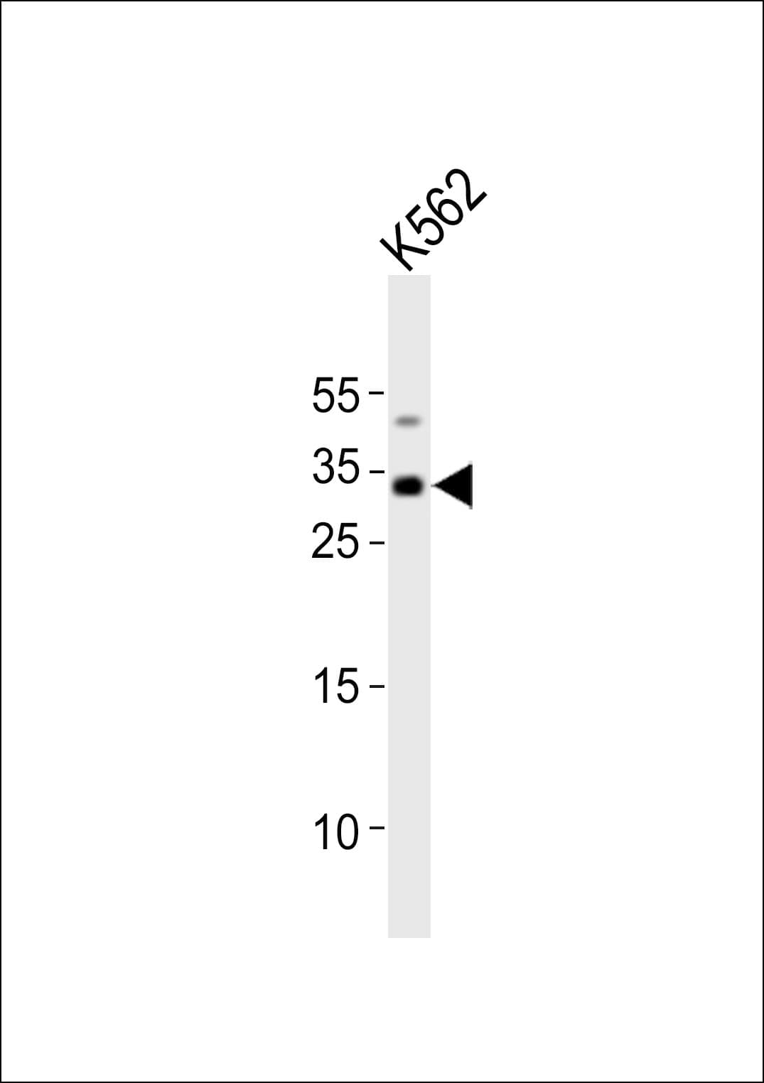 TAL1 Antibody (aa241-275)