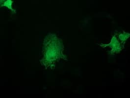 ASCC2 Antibody (clone OTI1E8)