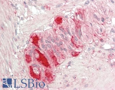 IHC-plus™ Polyclonal Rabbit anti-Human HSPD1 / HSP60 Antibody (aa300-350, IHC, WB)