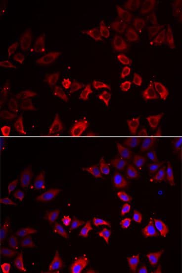Polyclonal Rabbit anti-Human LIMS1 / PINCH Antibody (IF, WB)