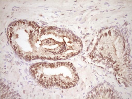 LPIN1 / Lipin 1 Antibody (clone OTI8F10)