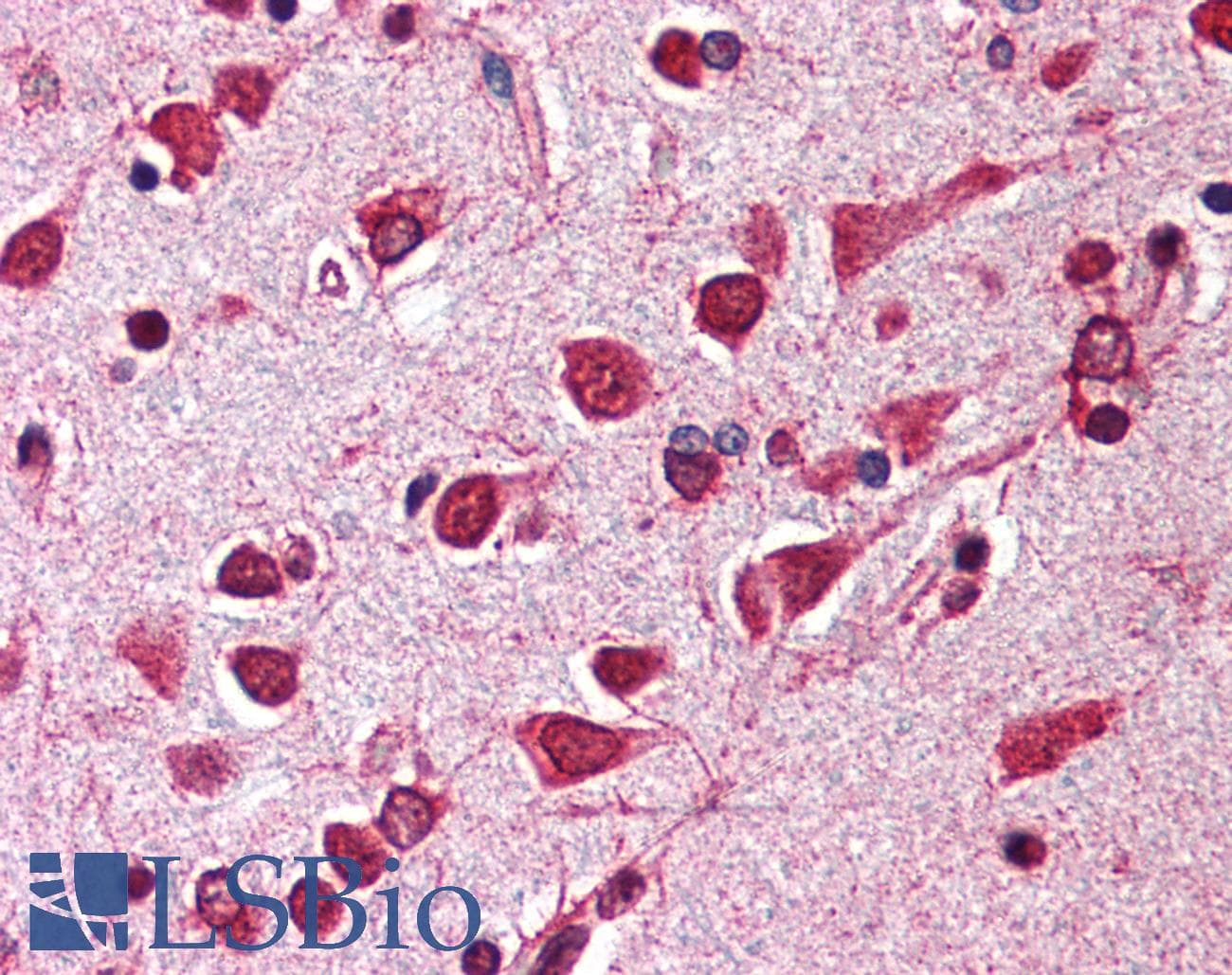 IHC-plus™ Polyclonal Rabbit anti-Human ARL6IP1 / ARMER Antibody (IHC, IF, WB)