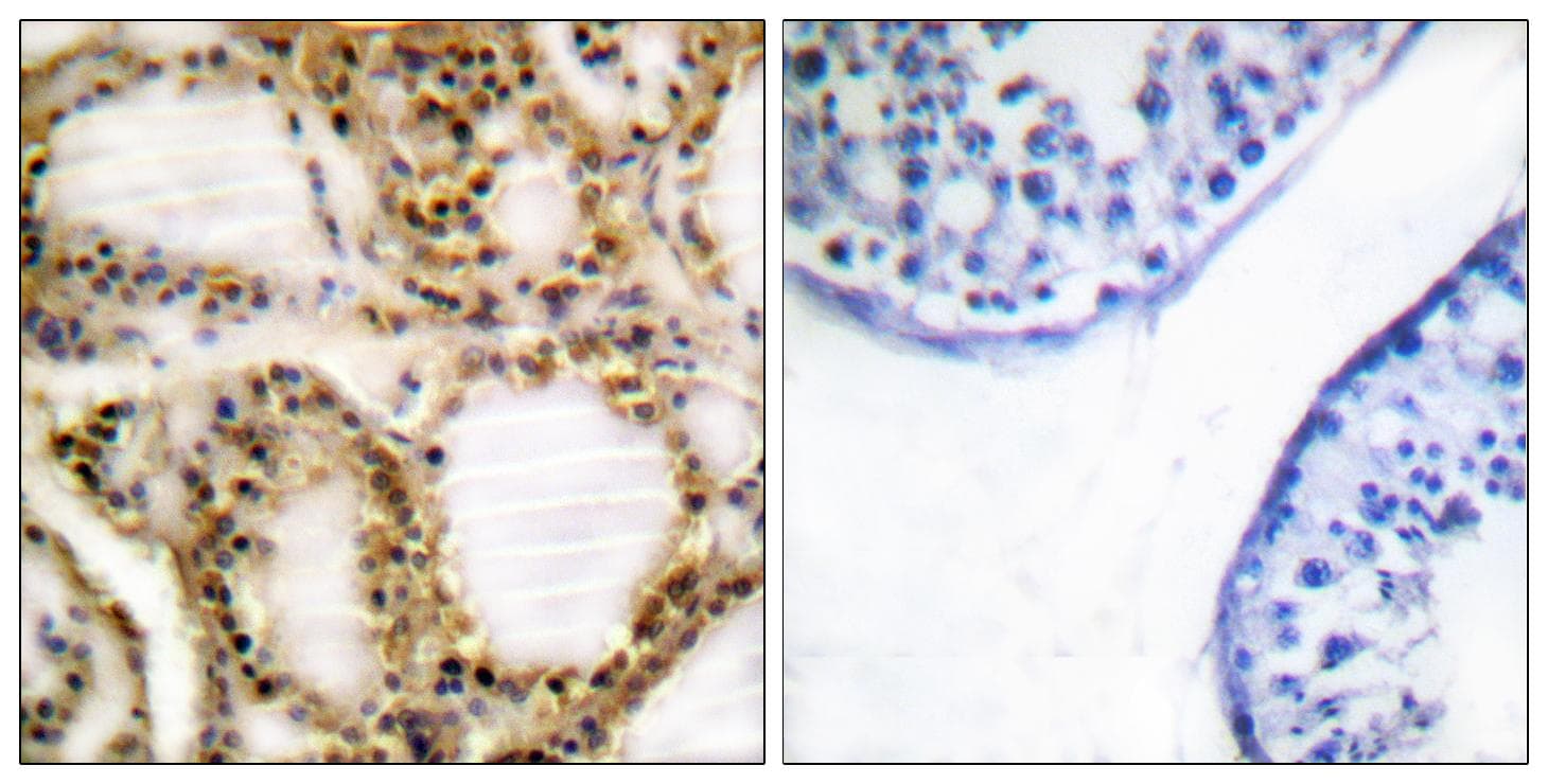 RB1 / Retinoblastoma / RB Antibody (phospho-Thr821)