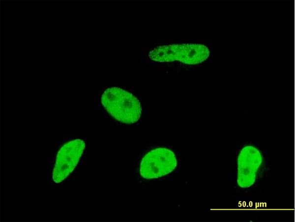 IHC-plus™ Monoclonal Mouse anti-Human Geminin Antibody (clone 1A8, IHC, IF, WB)