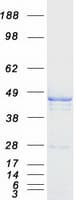 Human CBWD1 Protein (Recombinant Myc-DDK (Flag))