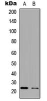Polyclonal Rabbit anti-Human APOBEC3C Antibody (N-Terminus, WB)
