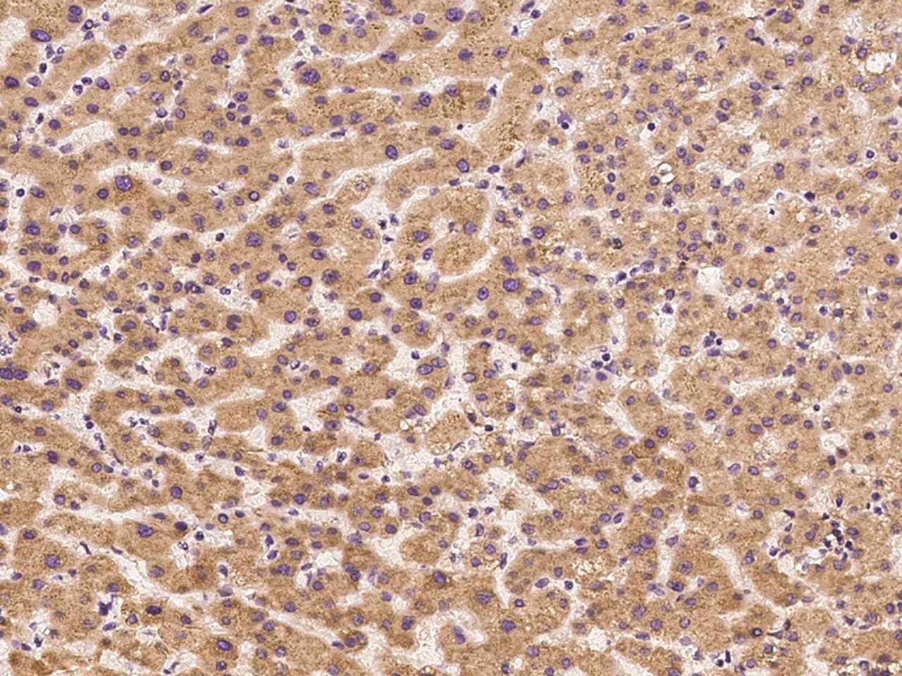FETUB / Fetuin B Antibody