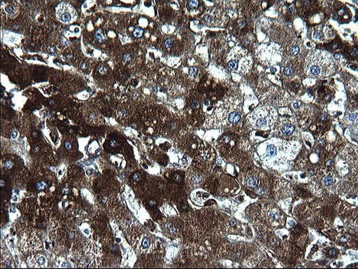 FGG / Fibrinogen Gamma Antibody (clone OTI1D11)