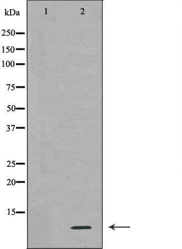 RPS27A Antibody