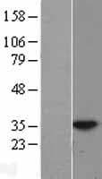 HUS1 Protein (Over-Expression Lysate Myc-DDK (Flag))
