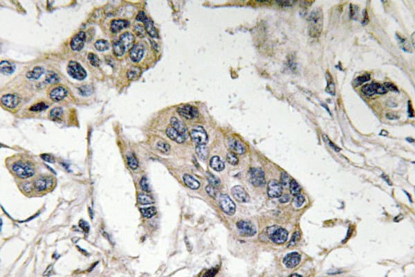 FUT4 / CD15 Antibody (Glu71)