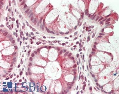 TSC22D1 / TSC22 Antibody (C-Terminus)