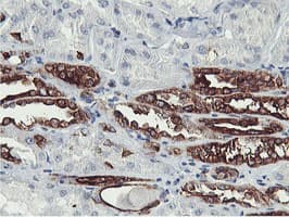 PFKP Antibody (clone OTI5F7)