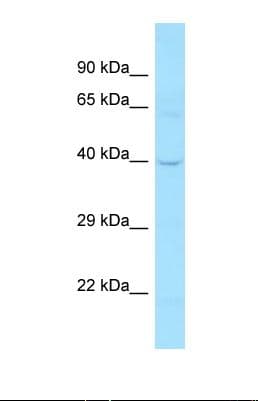 DCLK / DCLK1 Antibody (aa254-303)