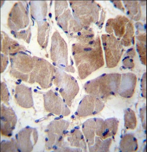 Polyclonal Rabbit anti-Human RPS6KC1 Antibody (aa20-47, IHC, WB)
