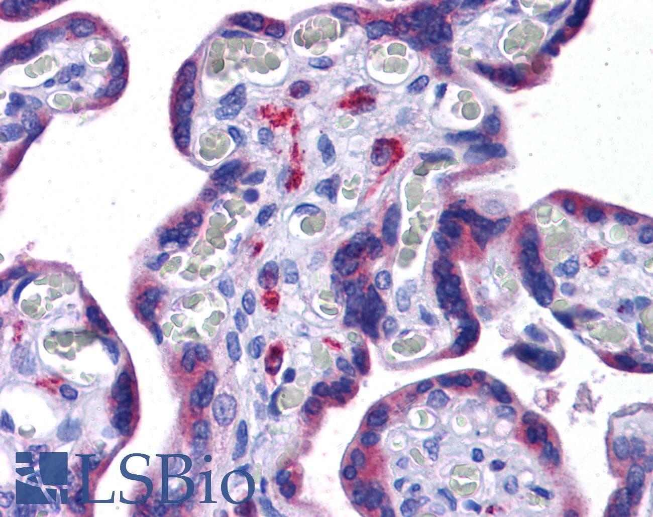 IHC-plus™ Polyclonal Rabbit anti-Human NOD3 / NLRC3 Antibody (IHC, IF, WB)