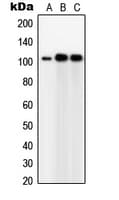 Polyclonal Rabbit anti-Human TUBGCP5 / GPC5 Antibody (Internal, WB)