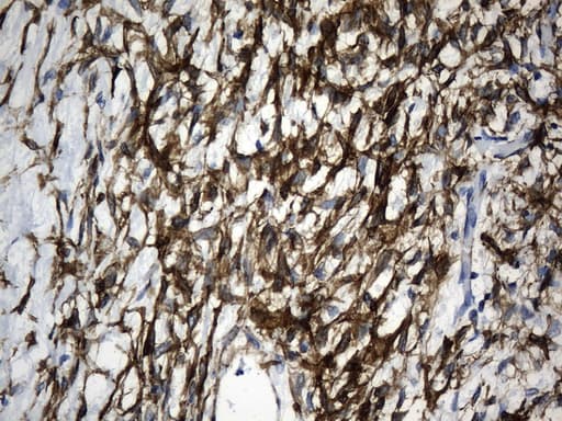 ACTA2 / Smooth Muscle Actin Antibody (N-Terminus, clone UMAB237)