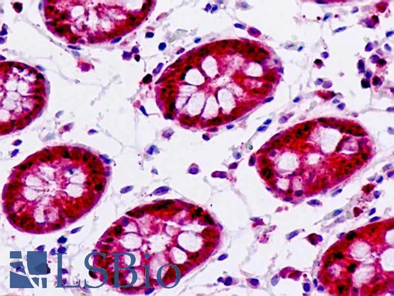 IHC-plus™ IP6K2 Antibody (aa161-210)