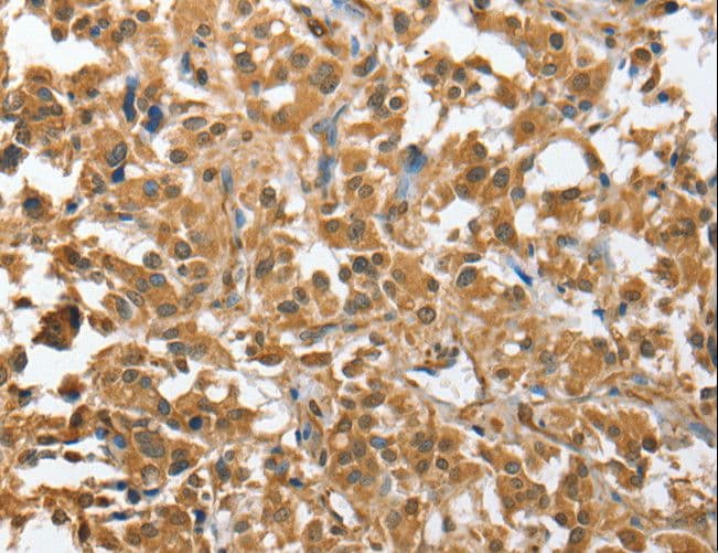 CHMP4B Antibody