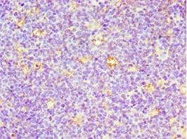 Polyclonal Rabbit anti-Human CD7 Antibody (aa26-180, IHC)