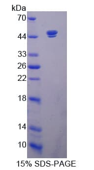 Human SIRT7 / Sirtuin 7 Protein (Recombinant His-T7)