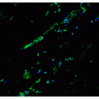 BCL9L Antibody