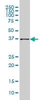 IHC-plus™ Monoclonal Mouse anti-Human AKR1B10 Antibody (clone 1A6, IHC, IF, WB)