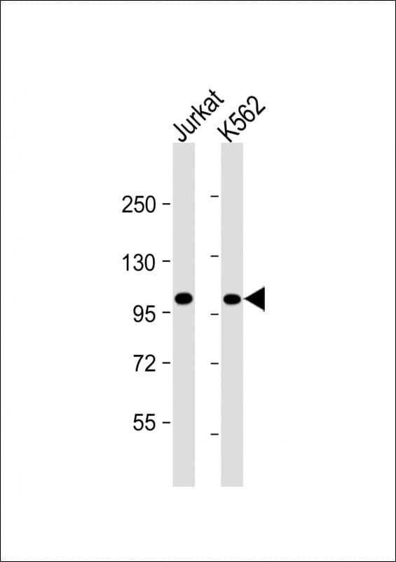 PRDM16 Antibody (clone 1740CT793.52.44)