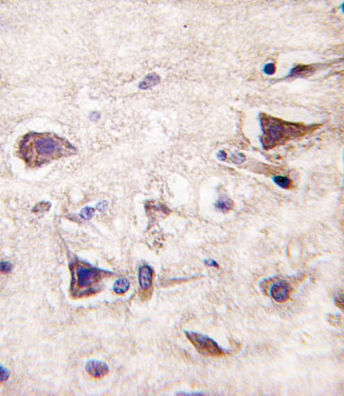 PDGF-AA Antibody (aa60-89)