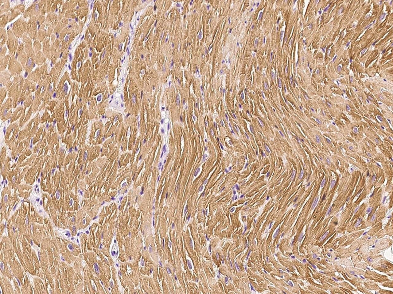 TNNC1 / Cardiac Troponin C Antibody (Preservative Free)