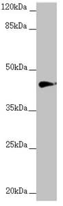 Polyclonal Rabbit anti-Human RNF13 Antibody (IHC, WB)