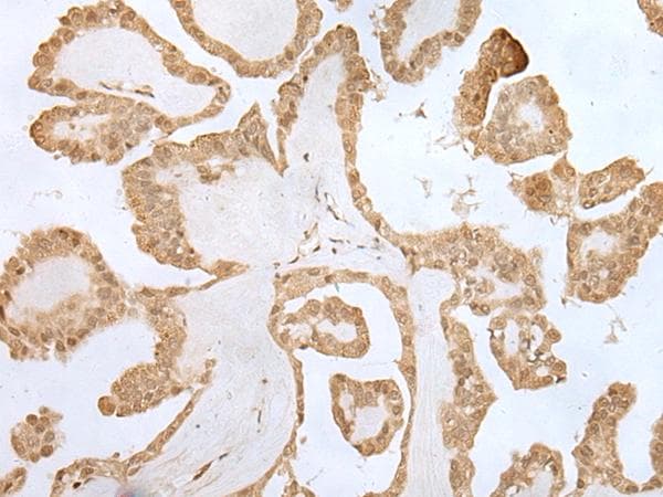 ZNF281 / Zfp281 Antibody