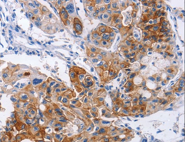 Polyclonal Rabbit anti-Human ICAM-1 / CD54 Antibody (IHC, WB)