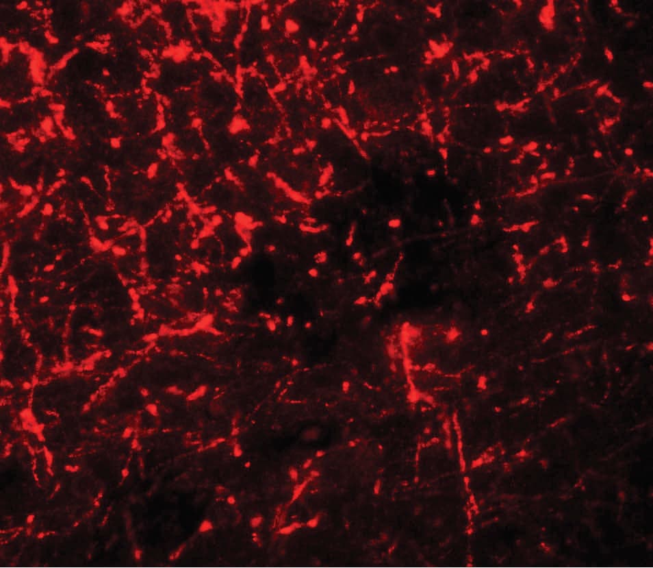SHISA4 Antibody