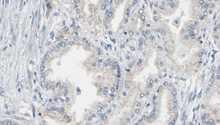 ANXA5 / Annexin V Antibody