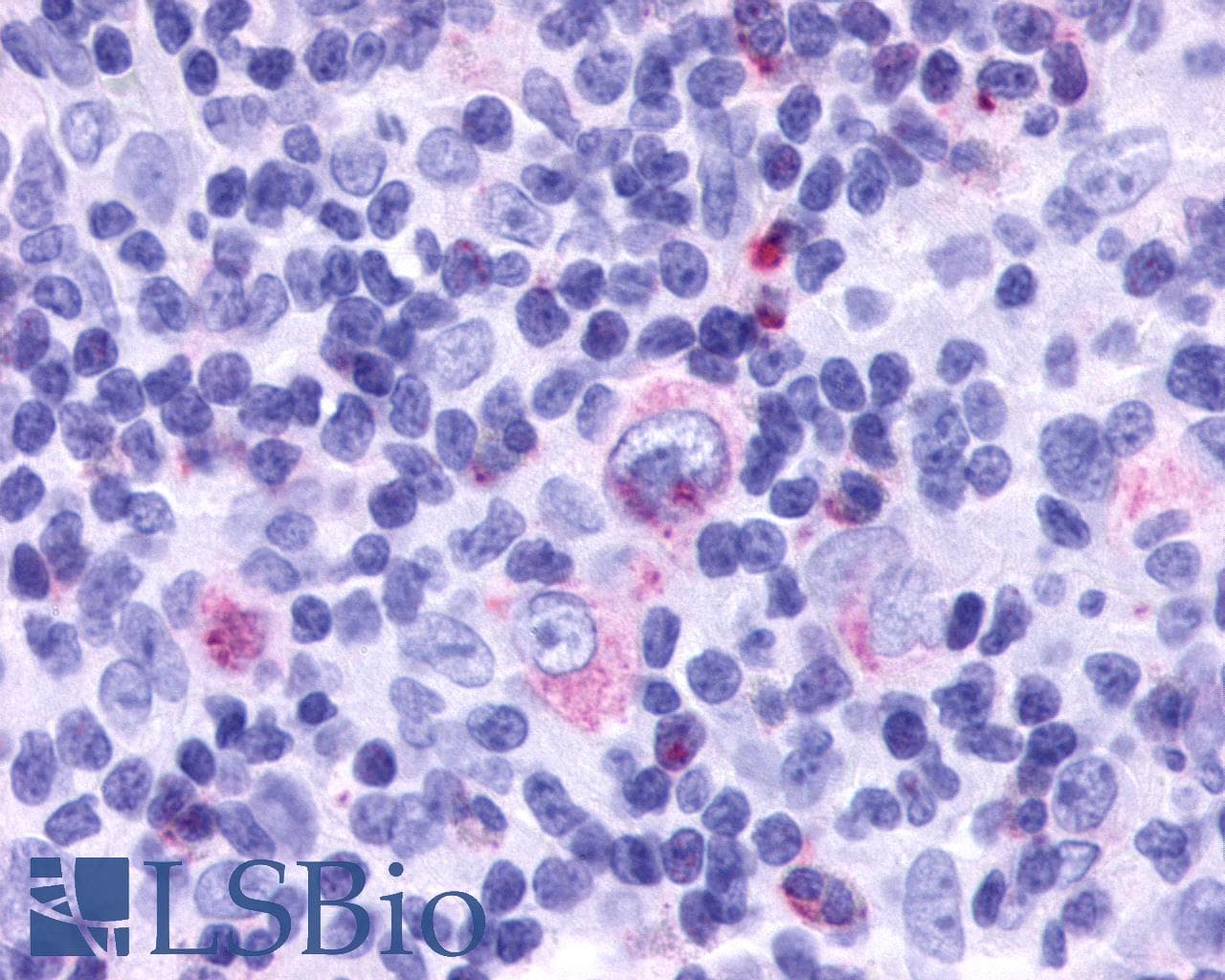IHC-plus™ CCRL2 Antibody (Cytoplasmic Domain)
